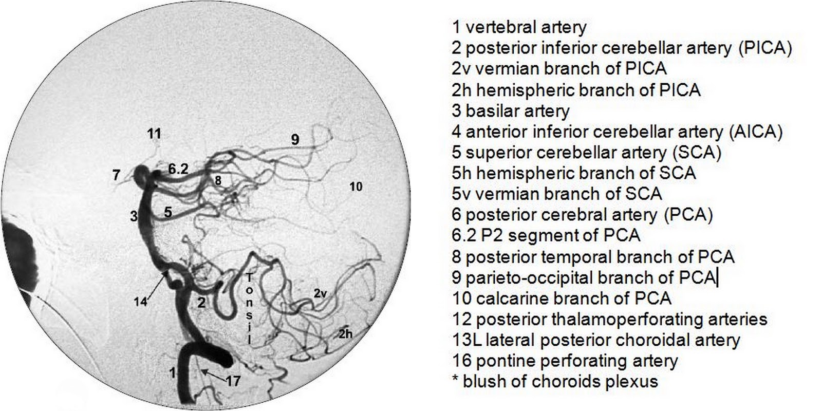 Vertebrobasilar normal anatomy (DSA)